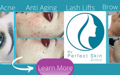 How to Have Better Skin