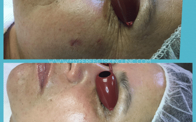 Choosing The Best Anti Aging Products