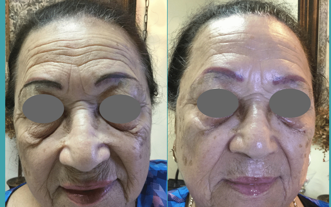 Have you tried Microcurrent or our Gold Lifting Mask to reduce lines and wrinkles?