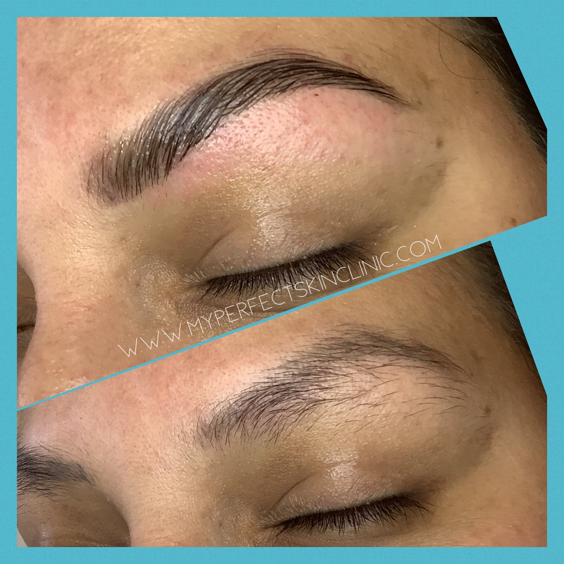 Brow Lamination - Before and After