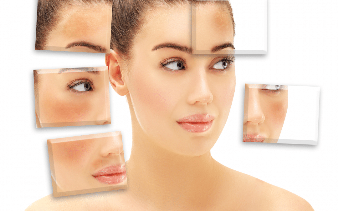 Hyperpigmentation Causes and treatments